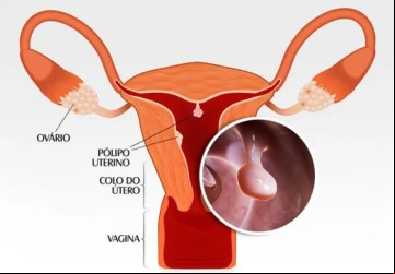 Foto: Clinica Viver